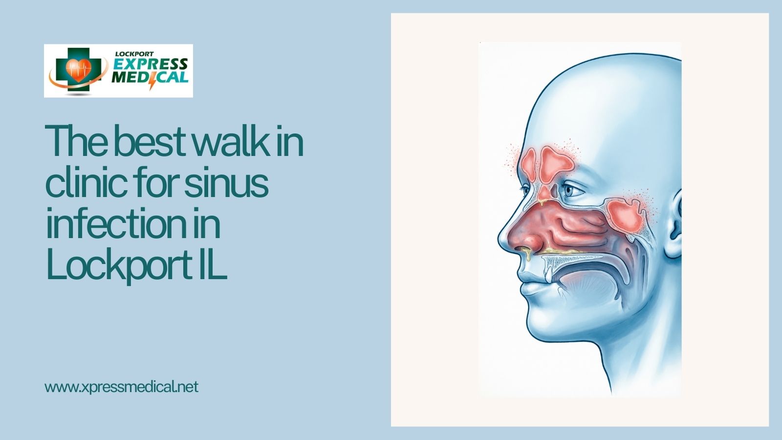 The best walk in clinic for sinus infection in Lockport IL