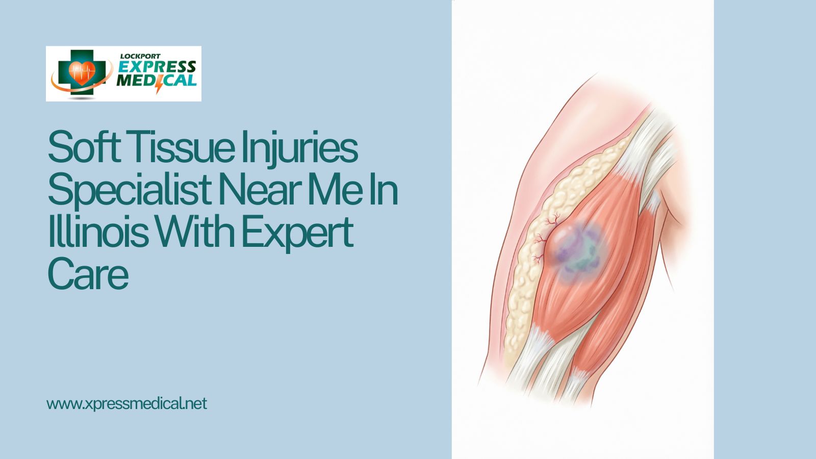 Soft Tissue Injuries Specialist Near Me In Illinois With Expert Care