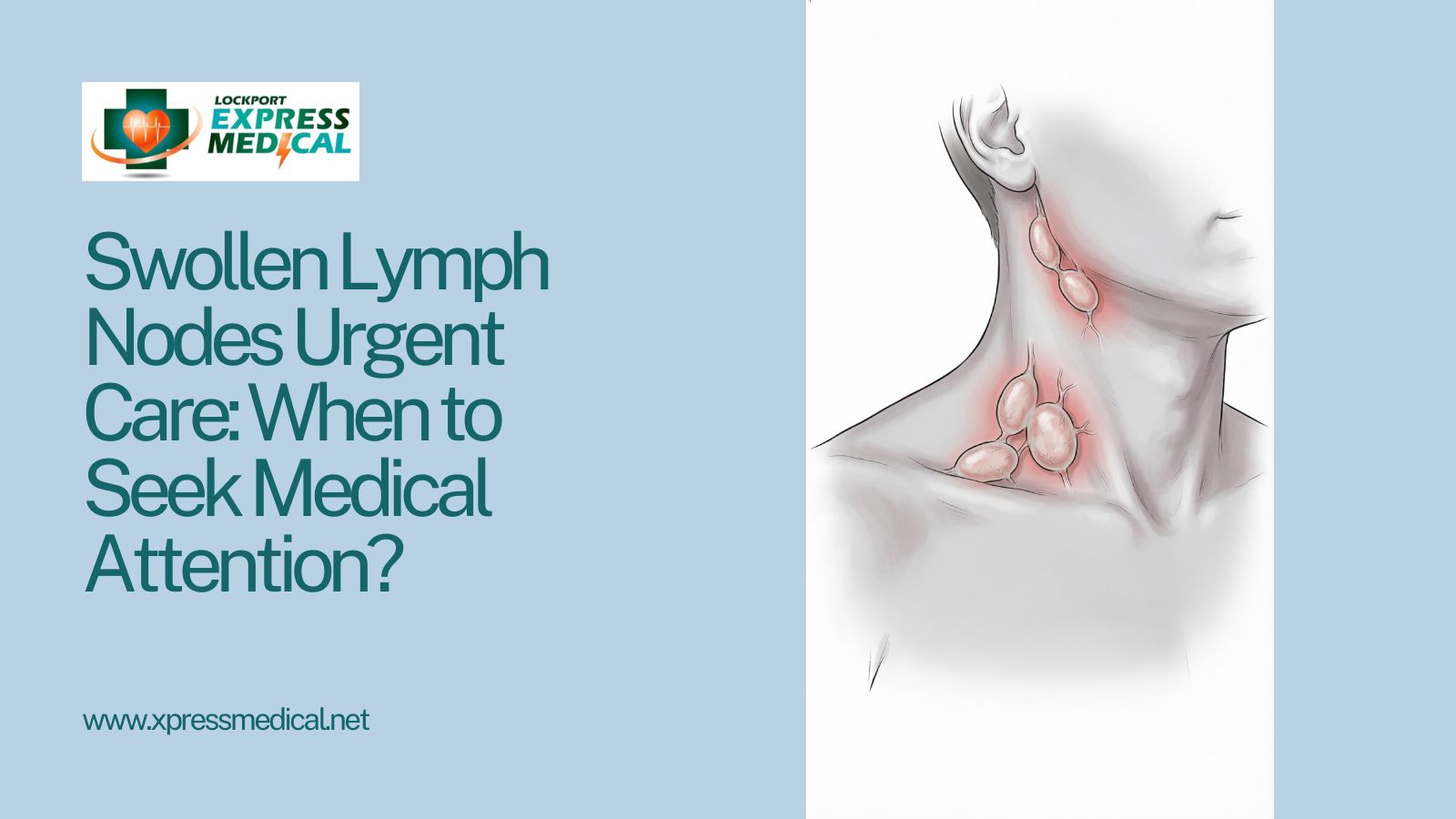 Swollen Lymph Nodes Urgent Care When to Seek Medical Attention