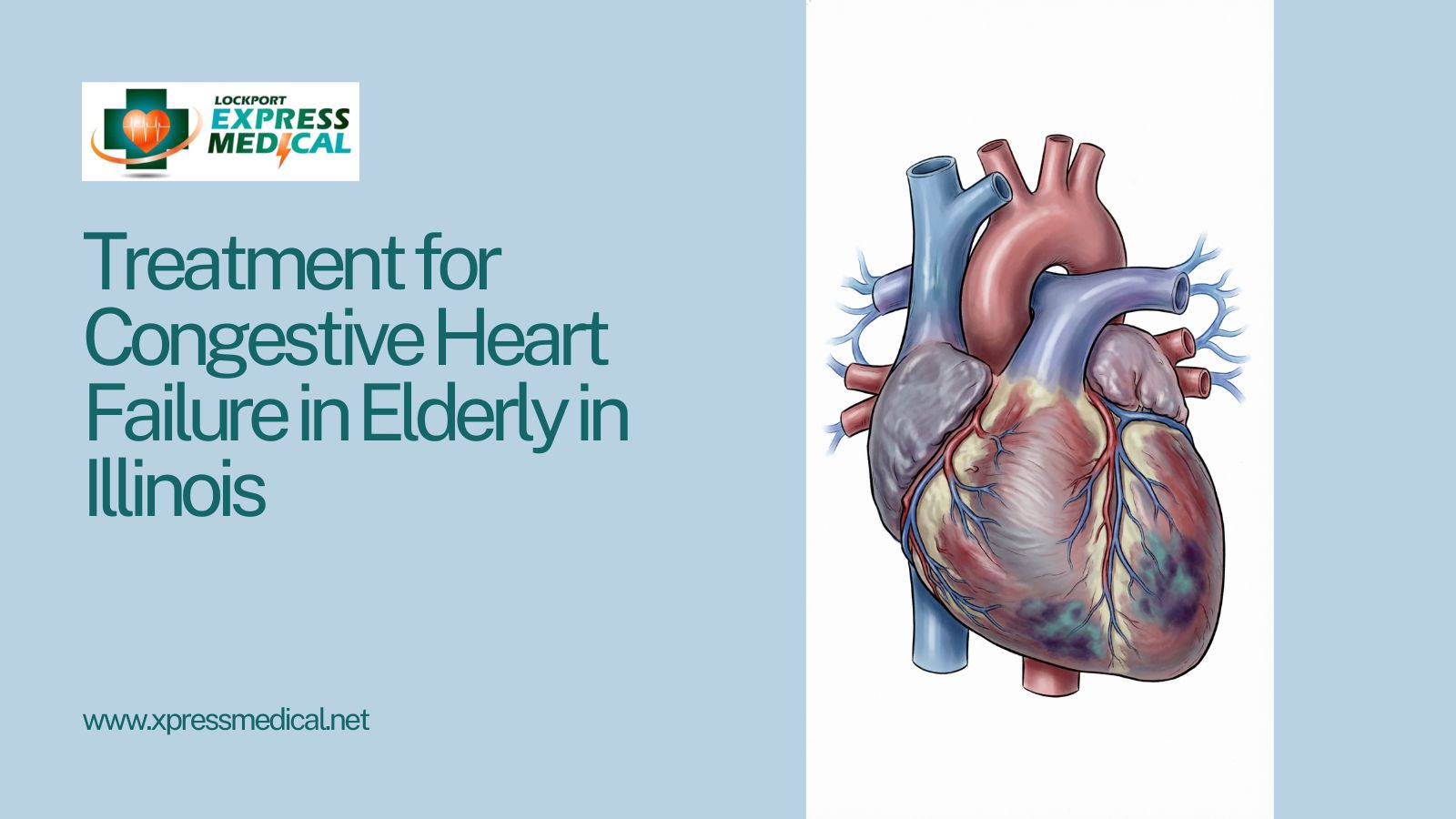 Treatment for Congestive Heart Failure in Elderly in Illinois