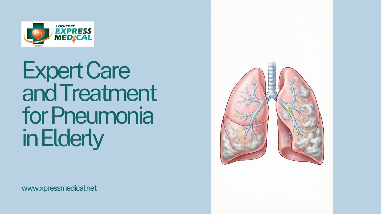 Expert Care and Treatment for Pneumonia in Elderly