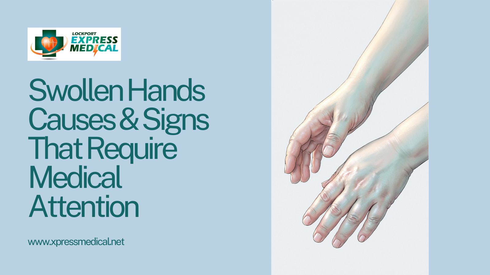 swollen hands causes