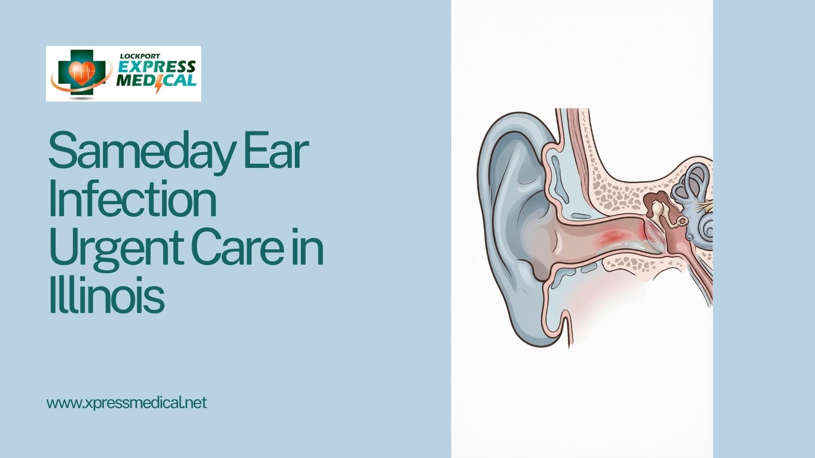 Sameday Ear Infection Urgent Care in Illinois