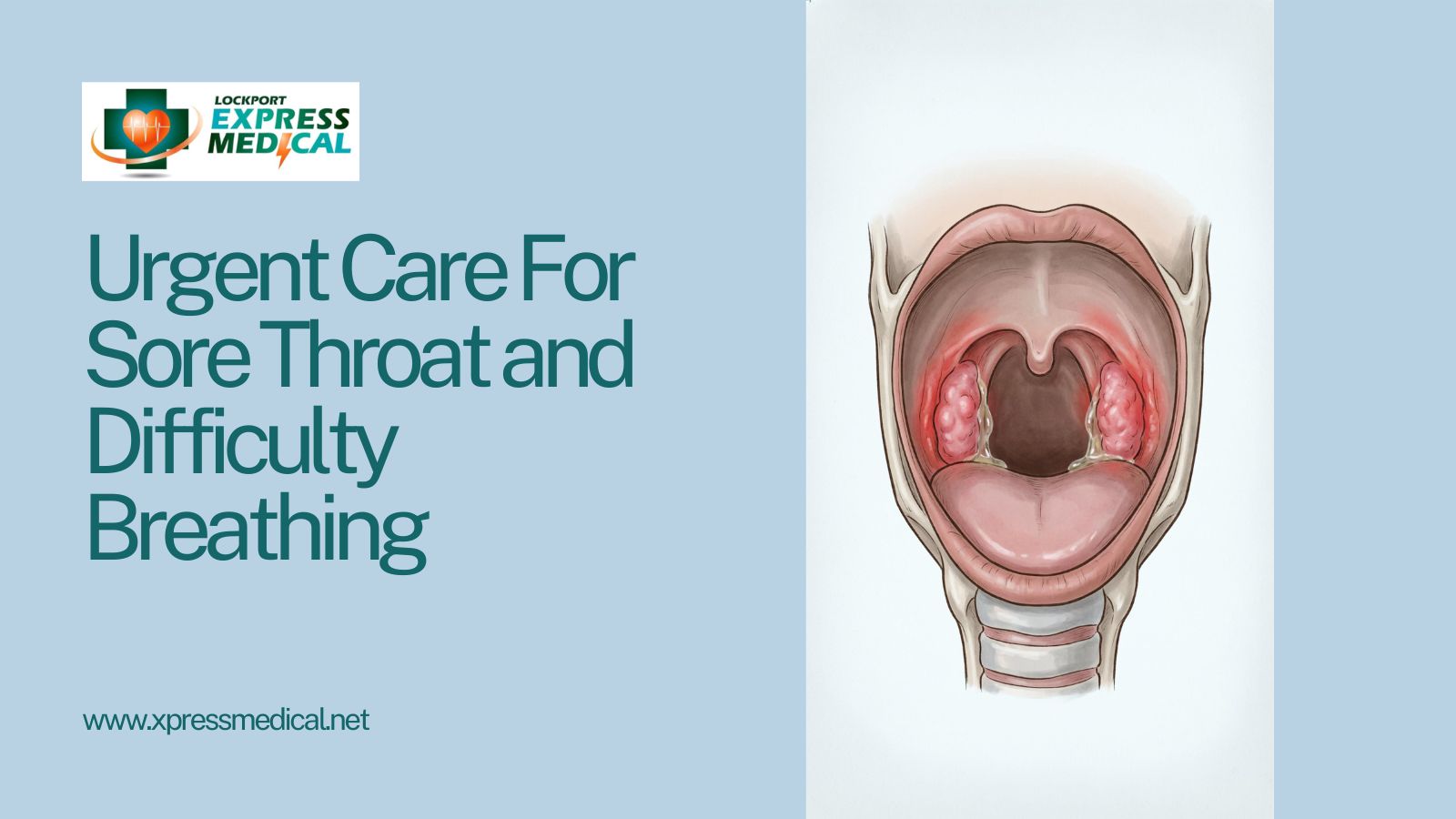 Urgent Care For Sore Throat
