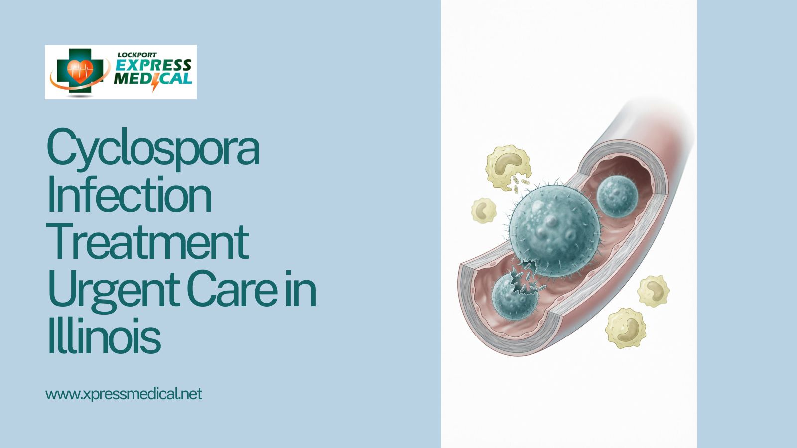 cyclospora infection treatment