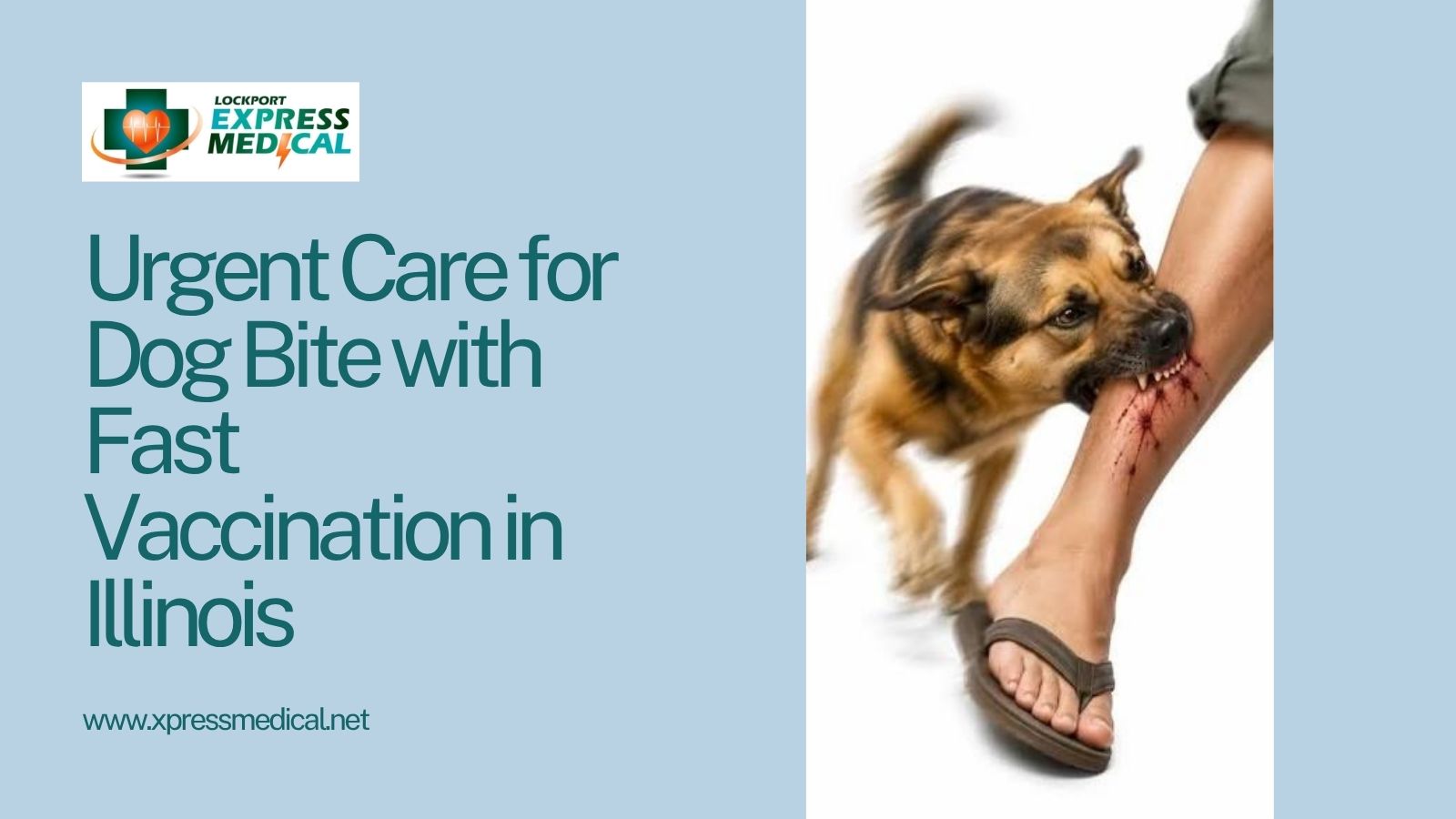 Urgent Care for Dog Bite